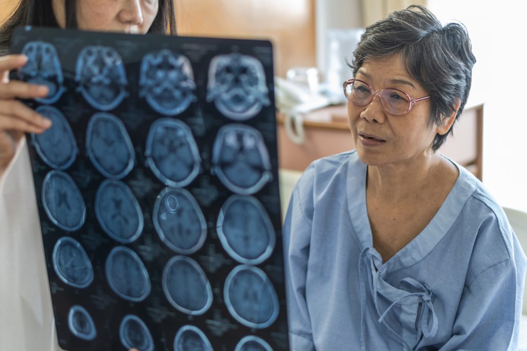 Doctor diagnosing elderly patient with neurodegenerative illness problem seeing Magnetic Resonance Imaging (MRI) film 